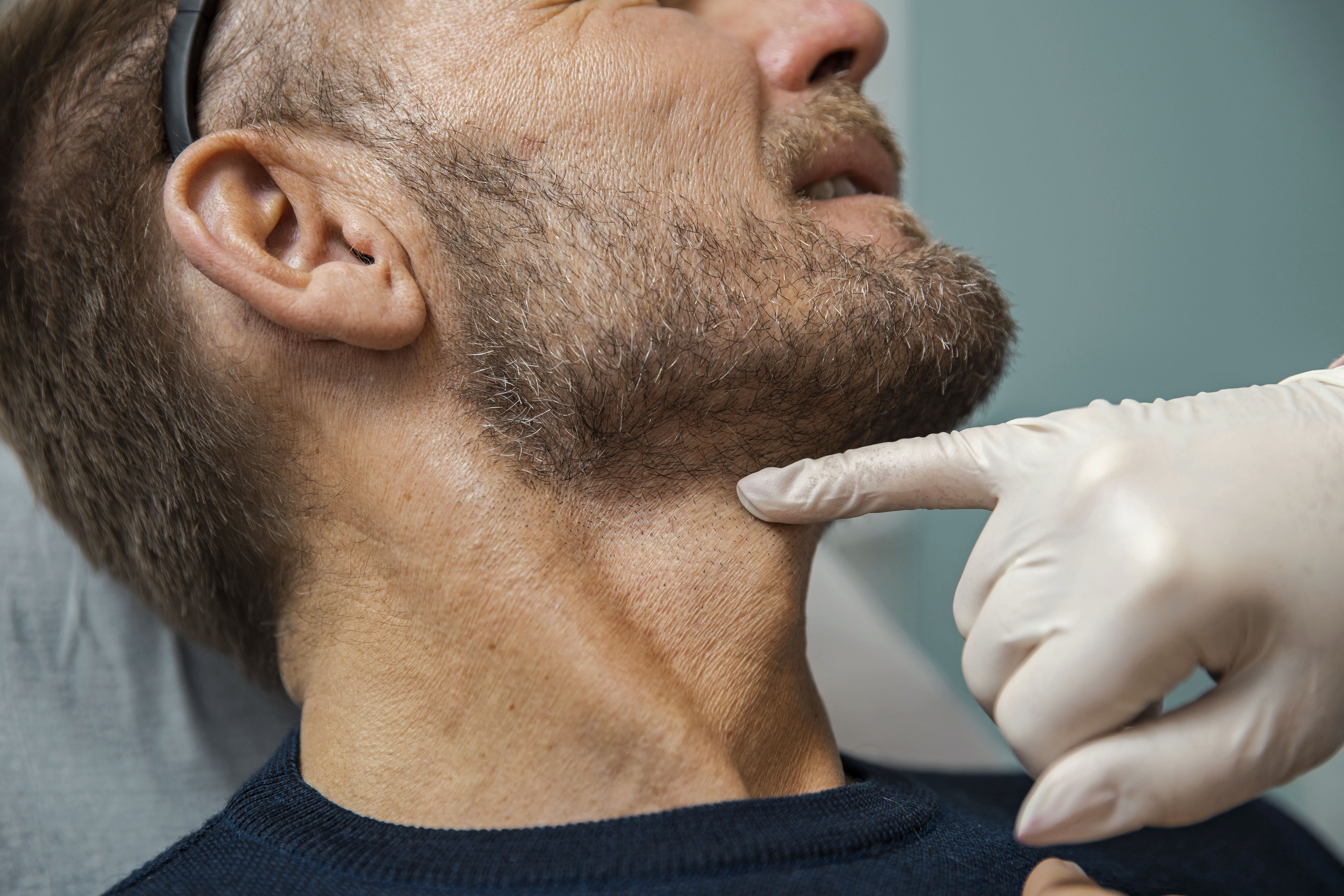 Mand til konsultation hos Cosmo Laser