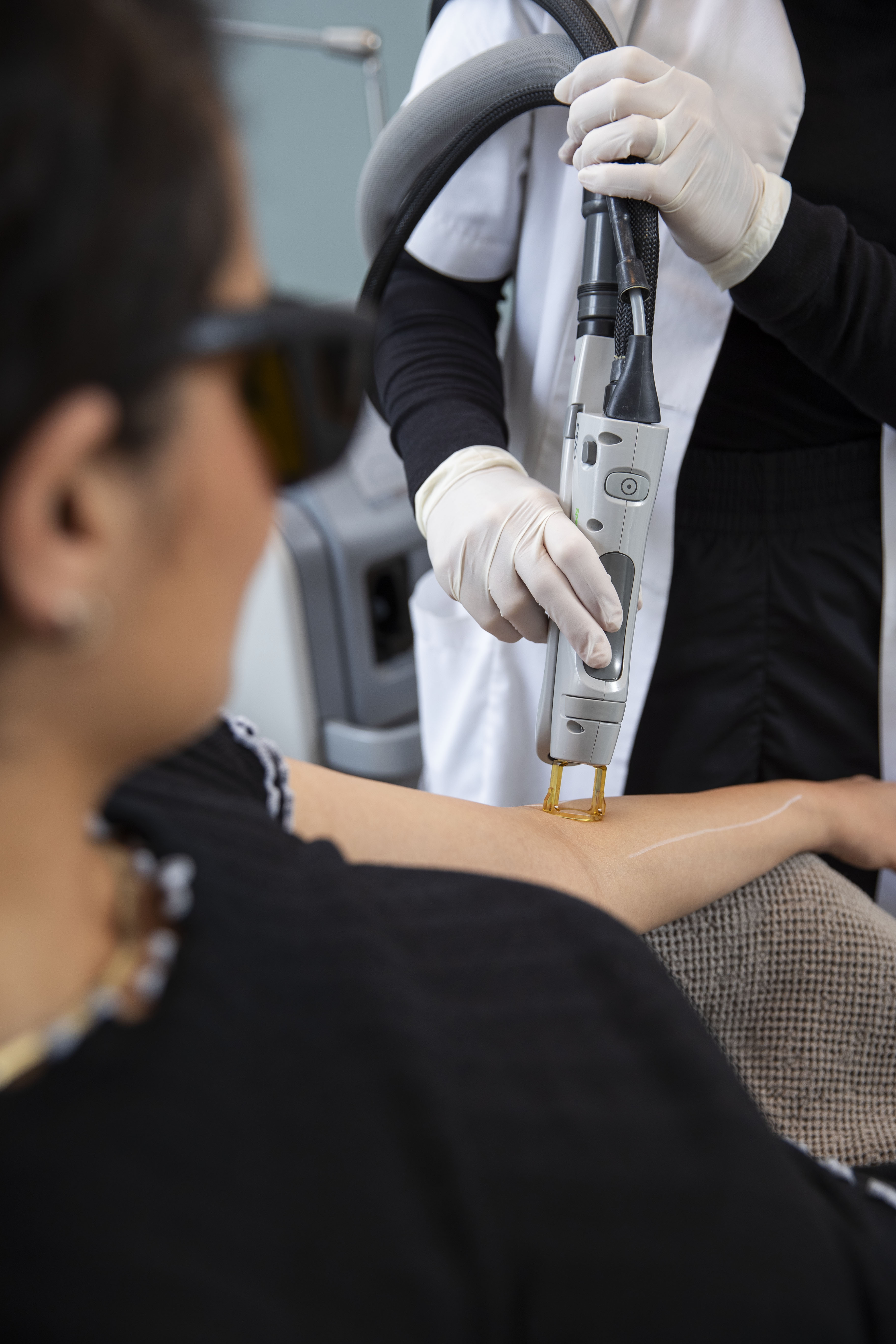 Permanent hårfjerning behandling